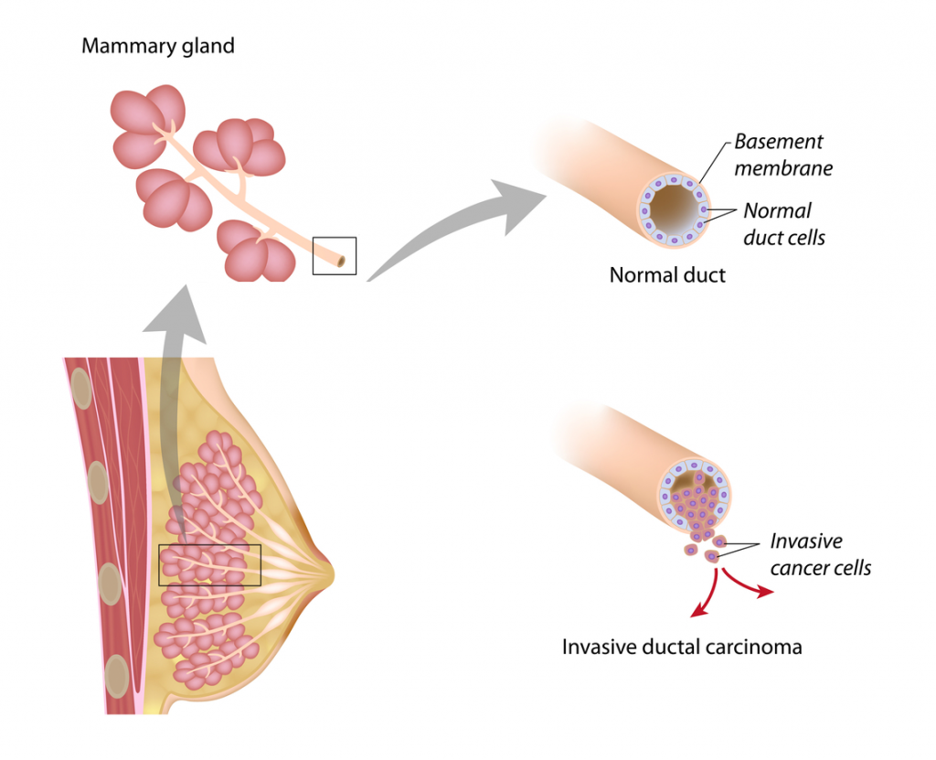 can breast cancer travel through blood